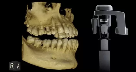 RTG – Rendgenska Dijagnostika
