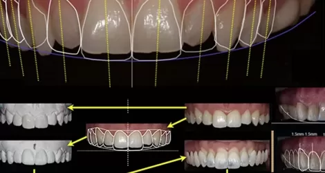 Digital Smile Design